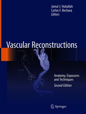 cover image of Vascular Reconstructions